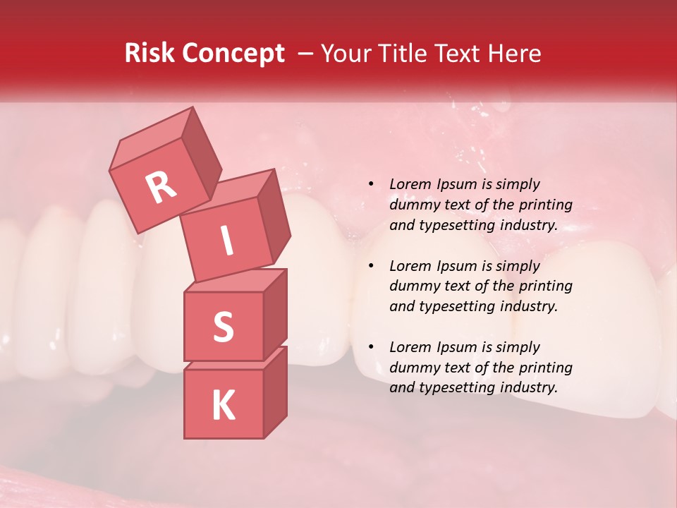 A Close Up Of A Tooth With A Plaque On It PowerPoint Template