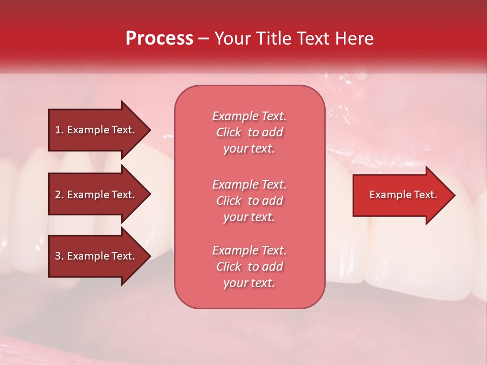 A Close Up Of A Tooth With A Plaque On It PowerPoint Template
