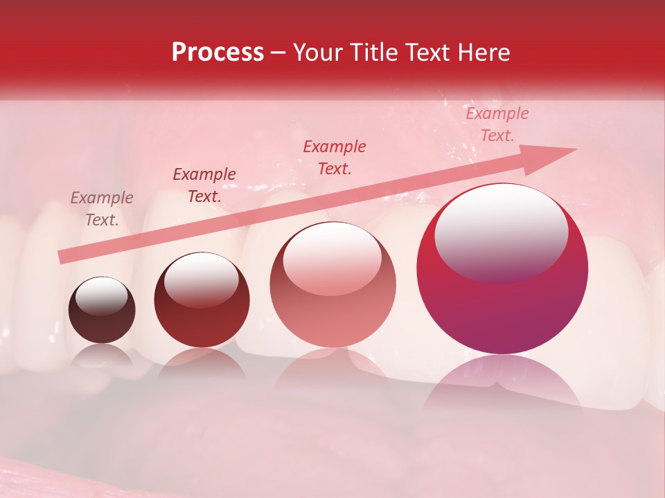 A Close Up Of A Tooth With A Plaque On It PowerPoint Template