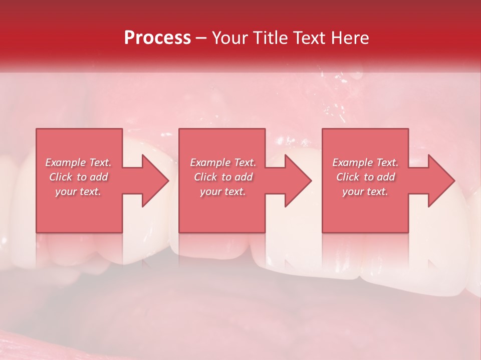 A Close Up Of A Tooth With A Plaque On It PowerPoint Template