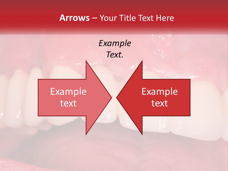 A Close Up Of A Tooth With A Plaque On It PowerPoint Template