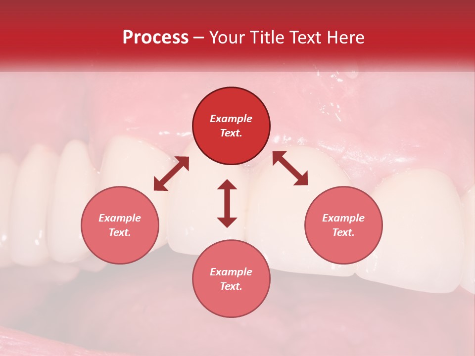 A Close Up Of A Tooth With A Plaque On It PowerPoint Template