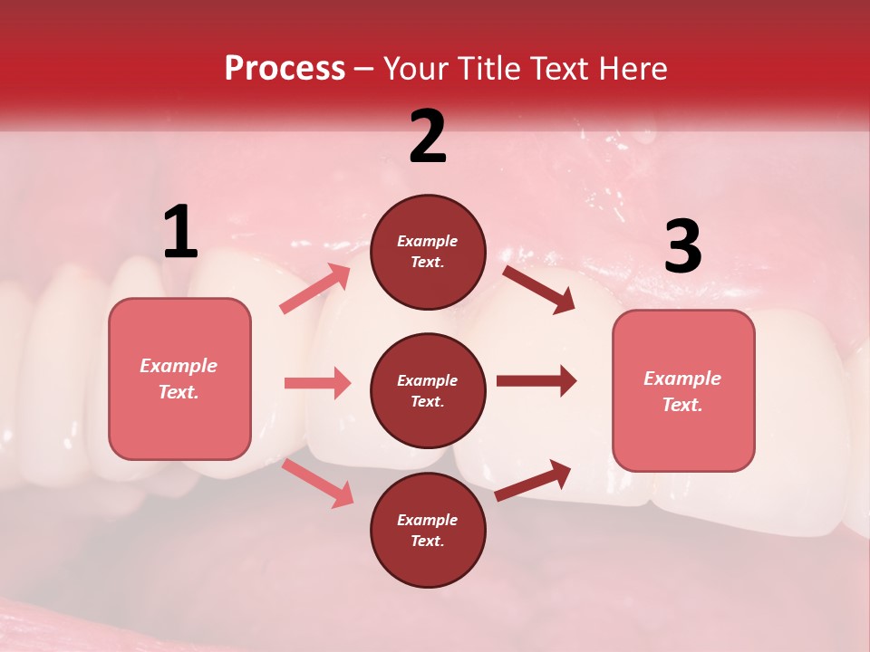A Close Up Of A Tooth With A Plaque On It PowerPoint Template