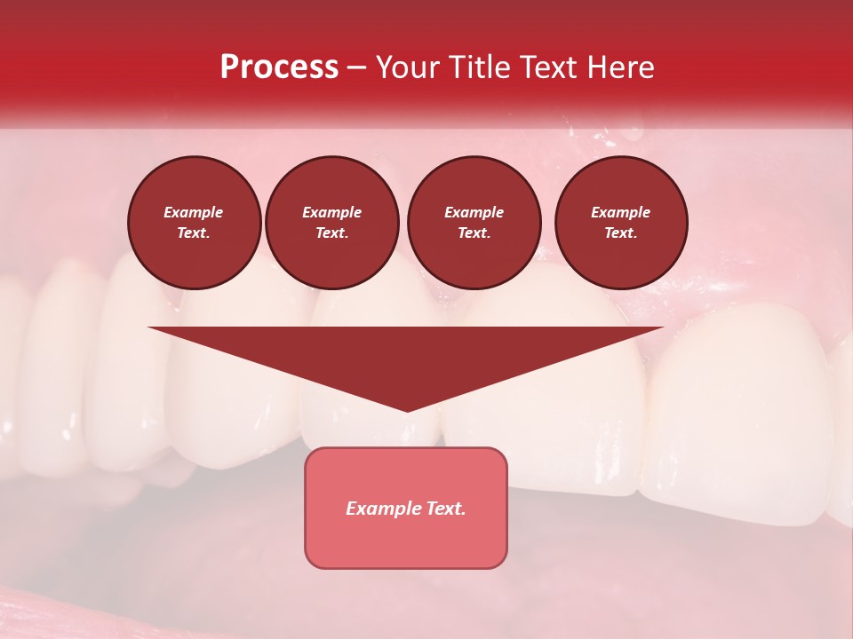 A Close Up Of A Tooth With A Plaque On It PowerPoint Template