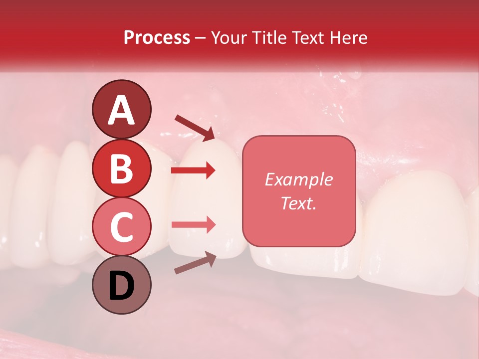 A Close Up Of A Tooth With A Plaque On It PowerPoint Template