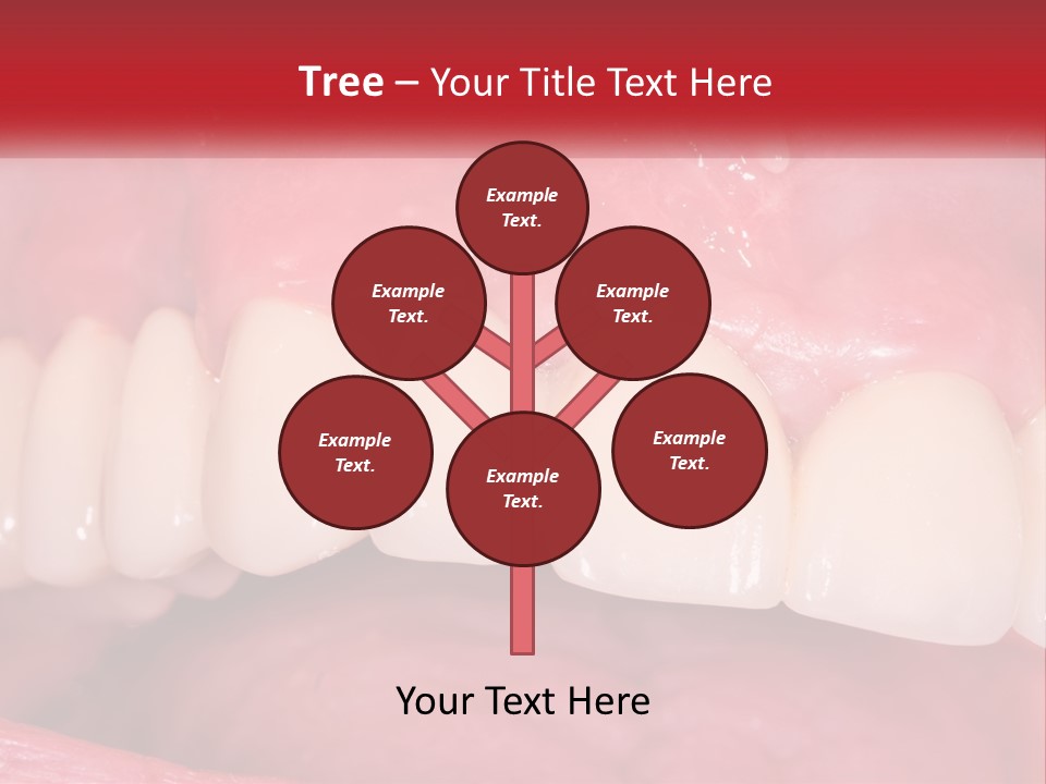 A Close Up Of A Tooth With A Plaque On It PowerPoint Template
