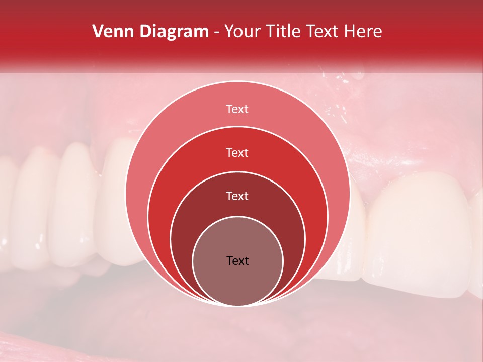 A Close Up Of A Tooth With A Plaque On It PowerPoint Template