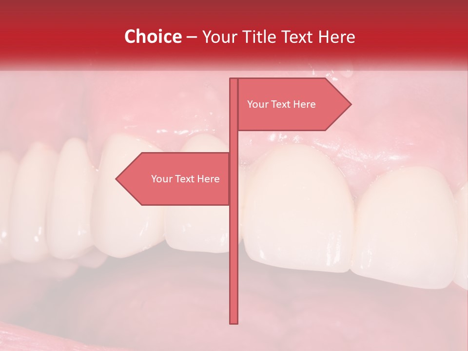A Close Up Of A Tooth With A Plaque On It PowerPoint Template