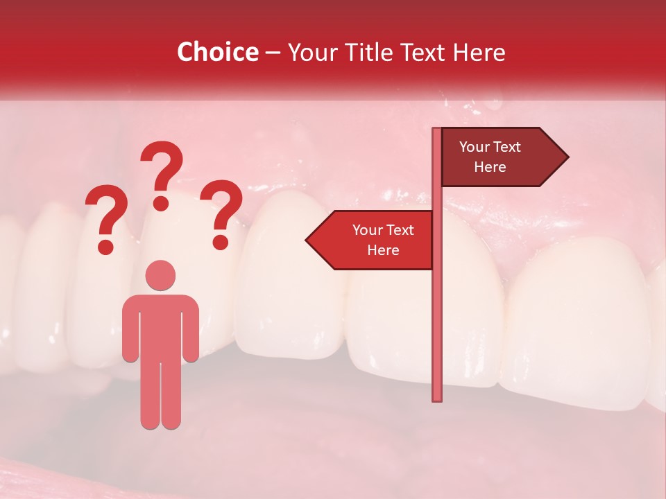 A Close Up Of A Tooth With A Plaque On It PowerPoint Template