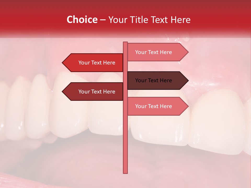 A Close Up Of A Tooth With A Plaque On It PowerPoint Template
