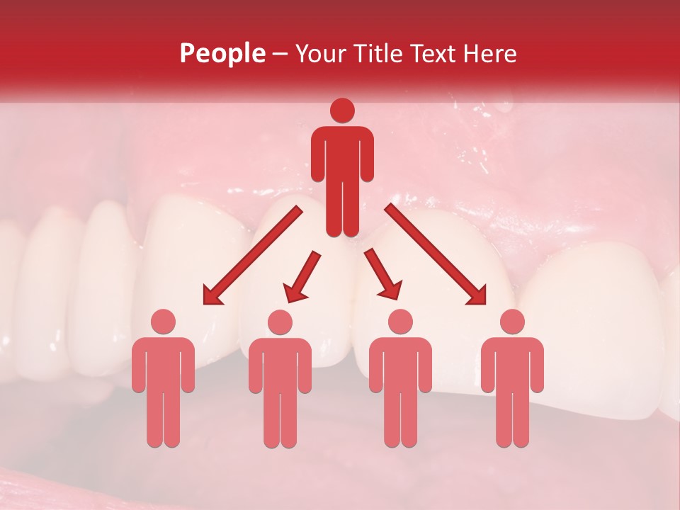 A Close Up Of A Tooth With A Plaque On It PowerPoint Template