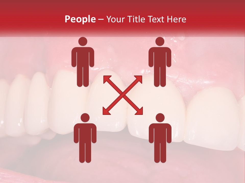 A Close Up Of A Tooth With A Plaque On It PowerPoint Template