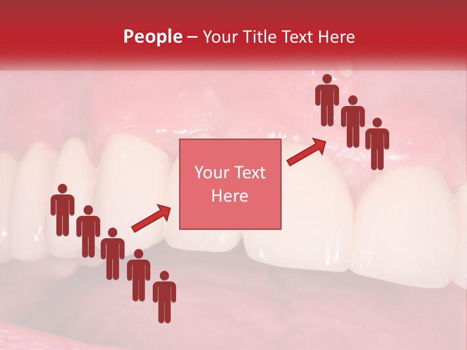 A Close Up Of A Tooth With A Plaque On It PowerPoint Template