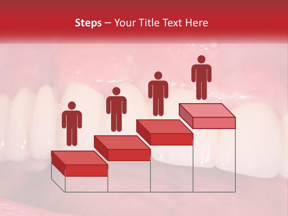 A Close Up Of A Tooth With A Plaque On It PowerPoint Template