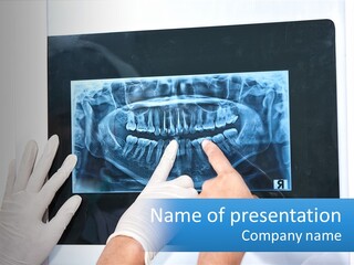A Person In White Gloves Pointing At A X - Ray PowerPoint Template