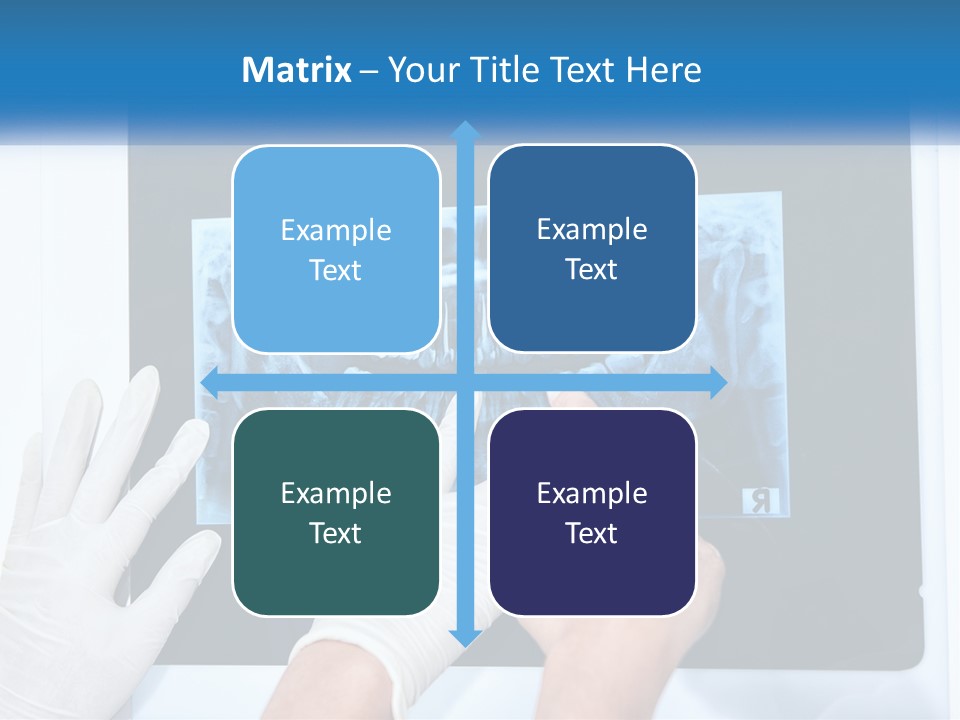 A Person In White Gloves Pointing At A X - Ray PowerPoint Template