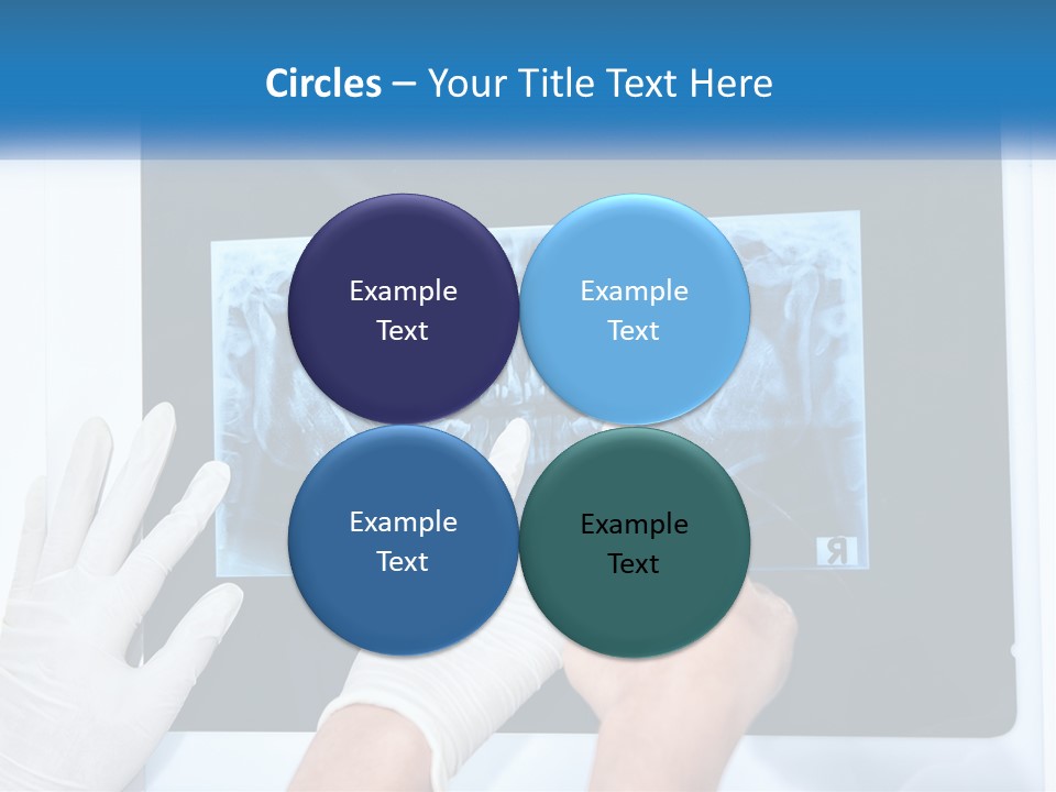 A Person In White Gloves Pointing At A X - Ray PowerPoint Template