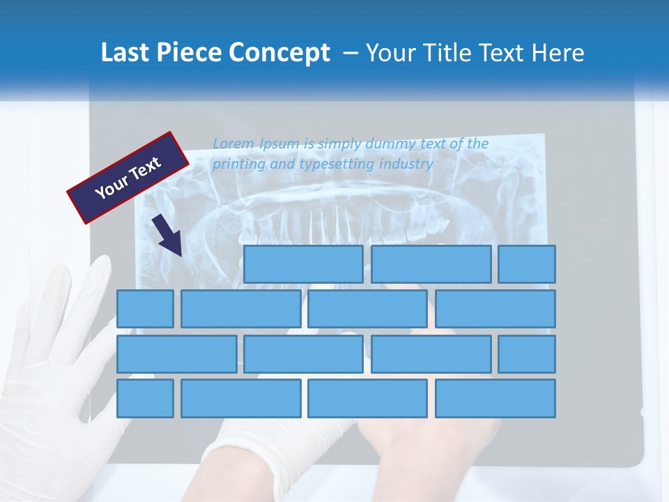 A Person In White Gloves Pointing At A X - Ray PowerPoint Template