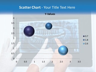 A Person In White Gloves Pointing At A X - Ray PowerPoint Template