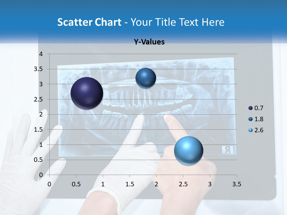 A Person In White Gloves Pointing At A X - Ray PowerPoint Template