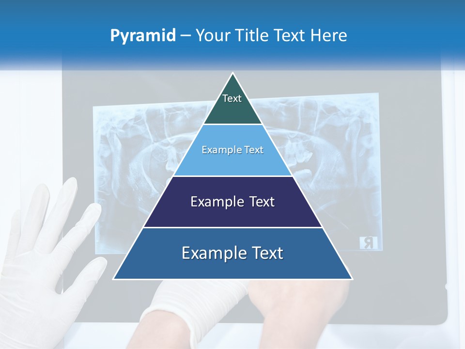 A Person In White Gloves Pointing At A X - Ray PowerPoint Template