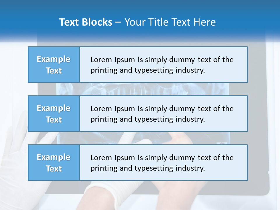 A Person In White Gloves Pointing At A X - Ray PowerPoint Template