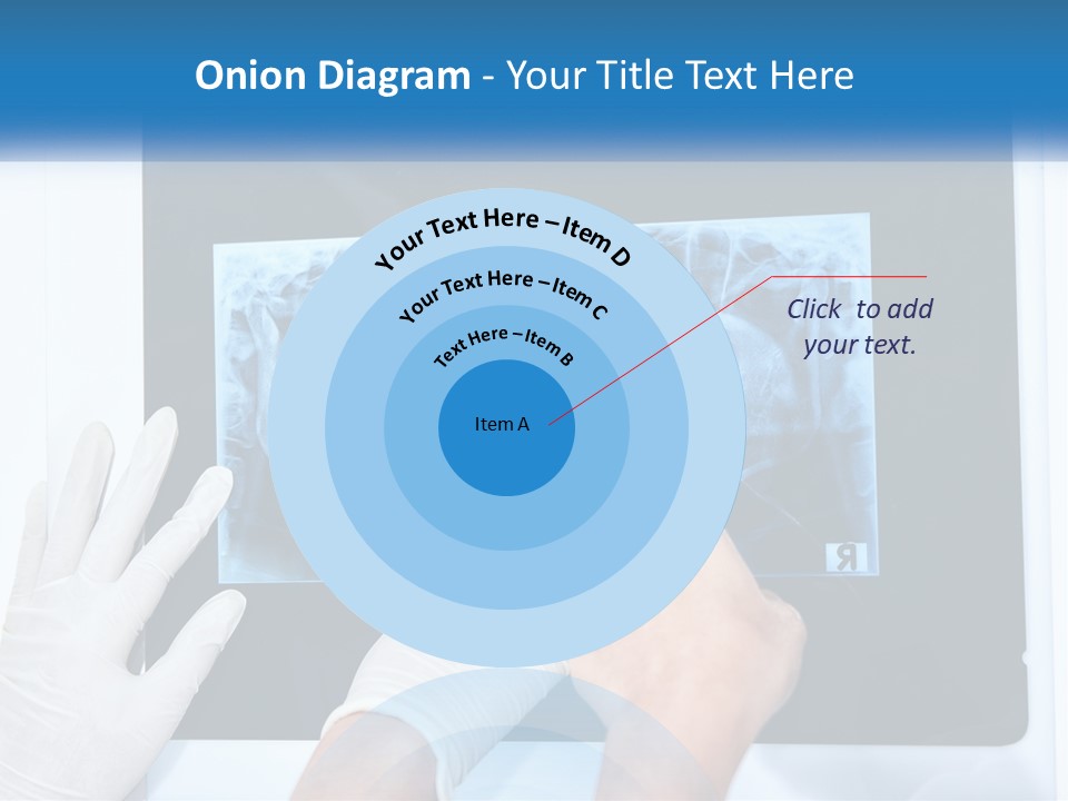 A Person In White Gloves Pointing At A X - Ray PowerPoint Template