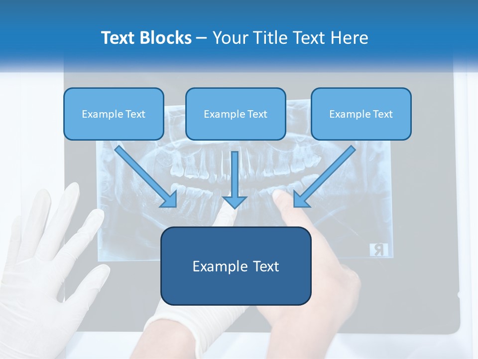 A Person In White Gloves Pointing At A X - Ray PowerPoint Template