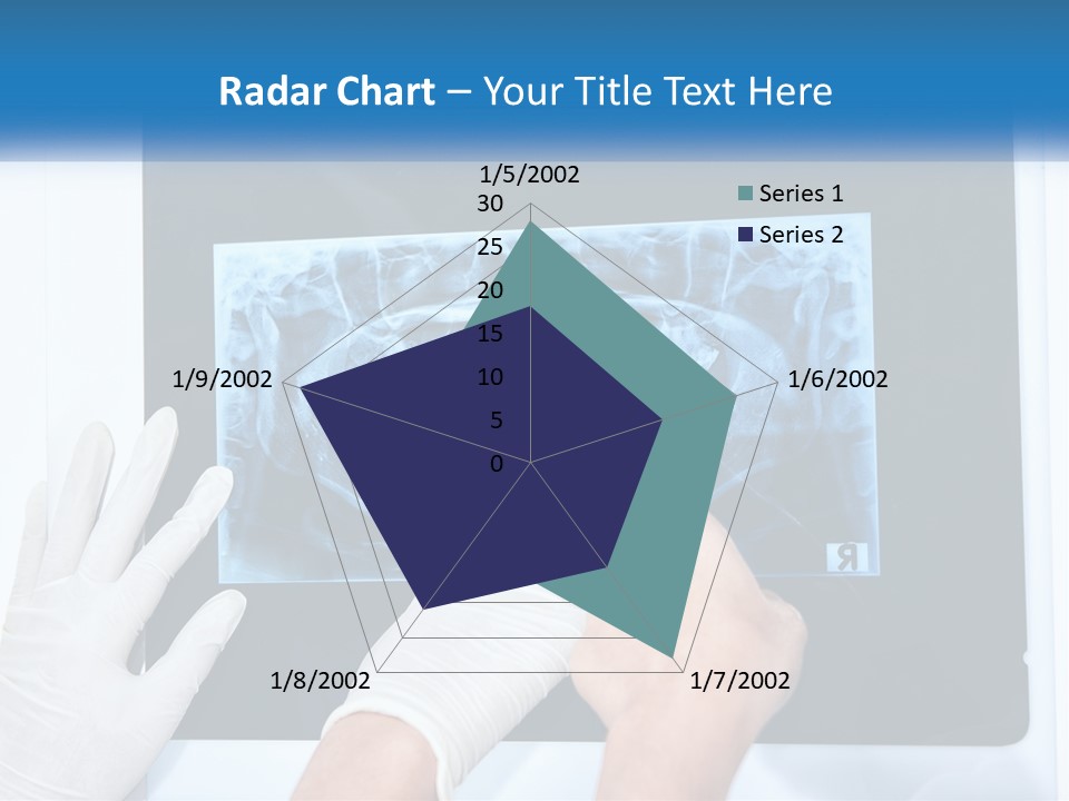 A Person In White Gloves Pointing At A X - Ray PowerPoint Template