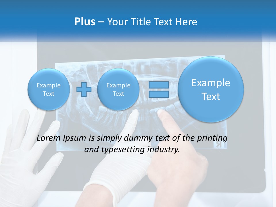 A Person In White Gloves Pointing At A X - Ray PowerPoint Template