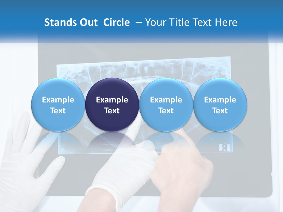 A Person In White Gloves Pointing At A X - Ray PowerPoint Template