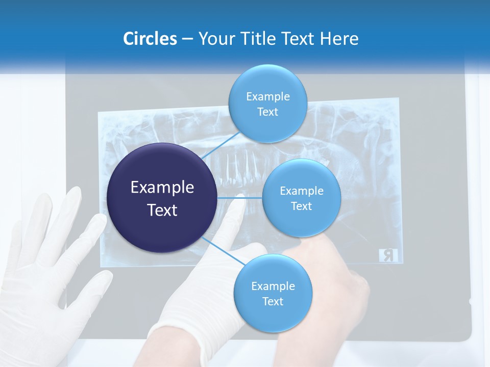 A Person In White Gloves Pointing At A X - Ray PowerPoint Template