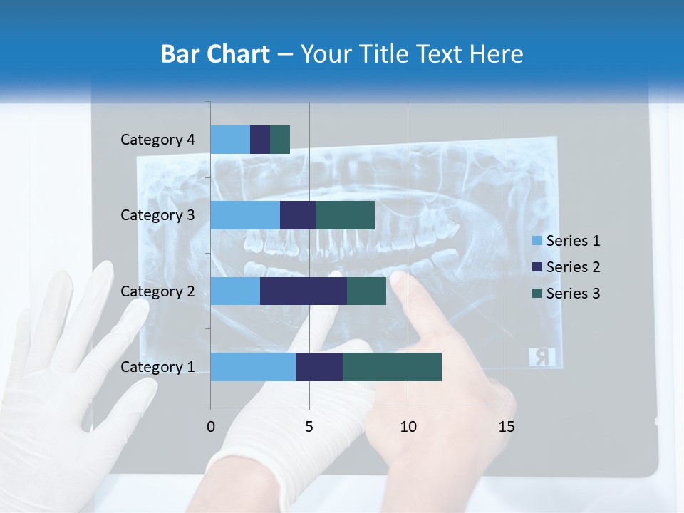 A Person In White Gloves Pointing At A X - Ray PowerPoint Template