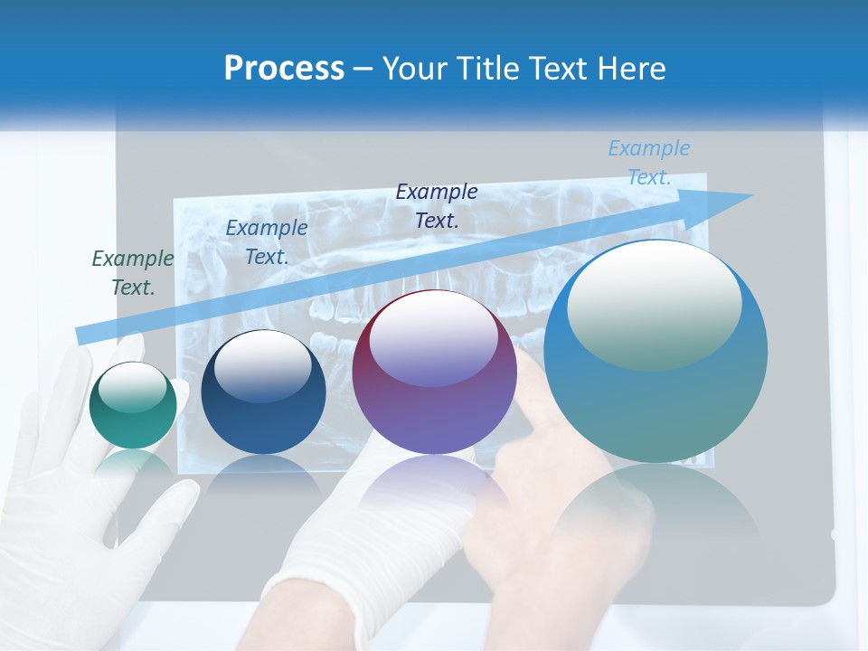 A Person In White Gloves Pointing At A X - Ray PowerPoint Template