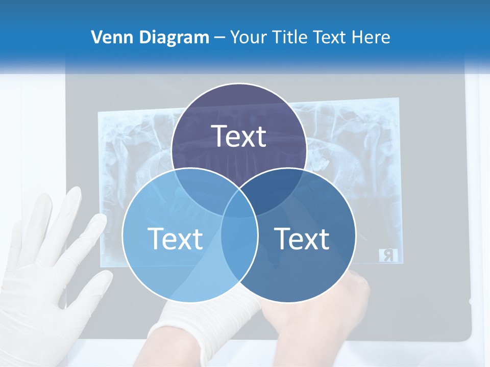 A Person In White Gloves Pointing At A X - Ray PowerPoint Template