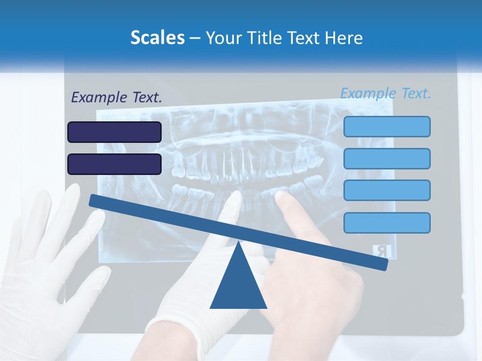 A Person In White Gloves Pointing At A X - Ray PowerPoint Template