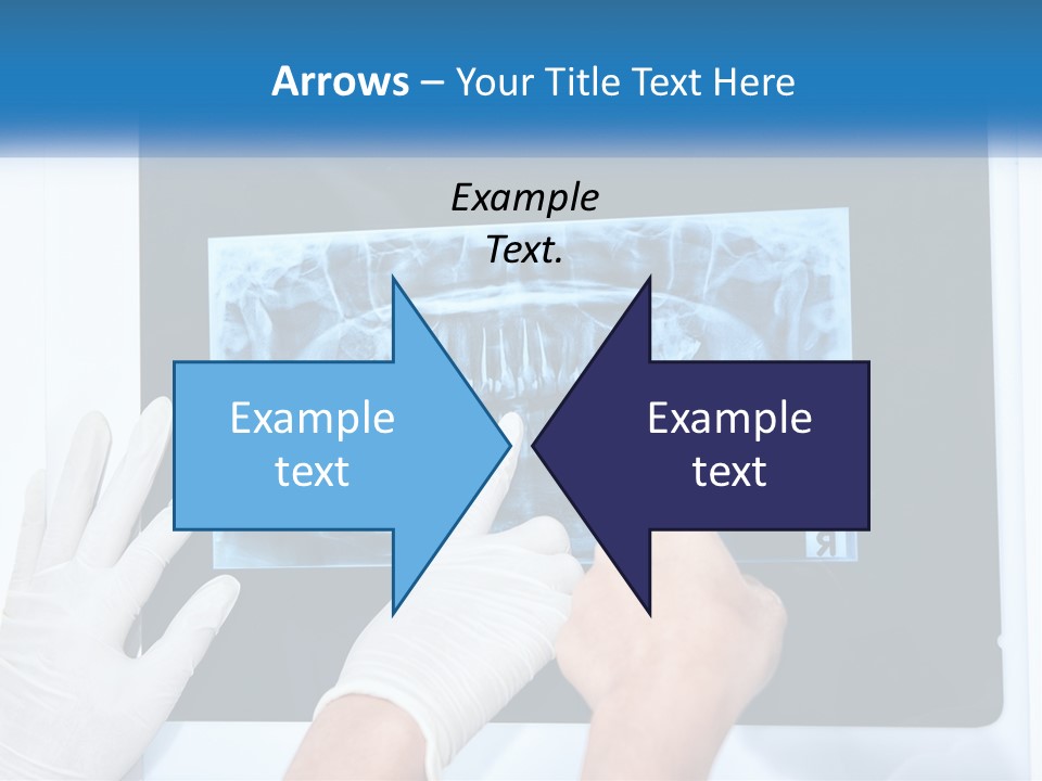 A Person In White Gloves Pointing At A X - Ray PowerPoint Template