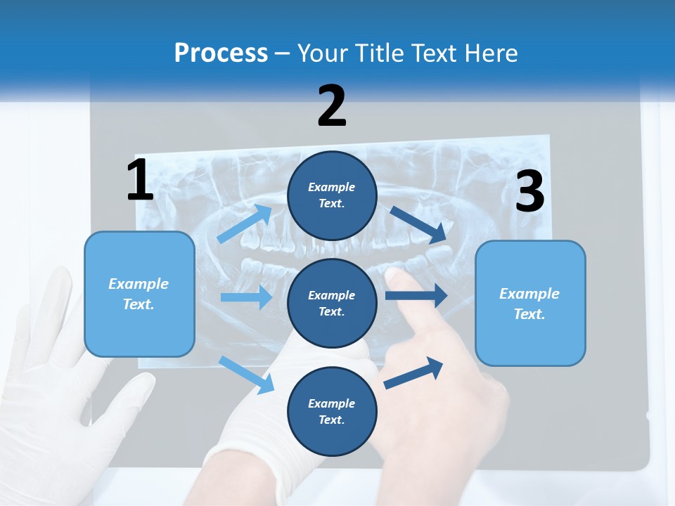 A Person In White Gloves Pointing At A X - Ray PowerPoint Template