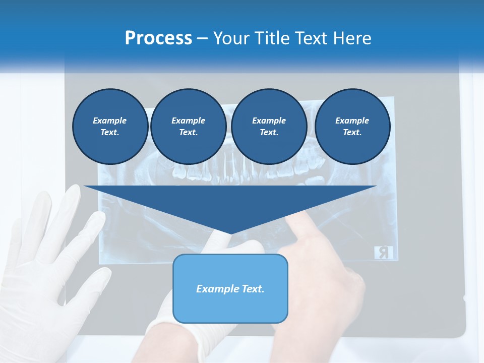 A Person In White Gloves Pointing At A X - Ray PowerPoint Template
