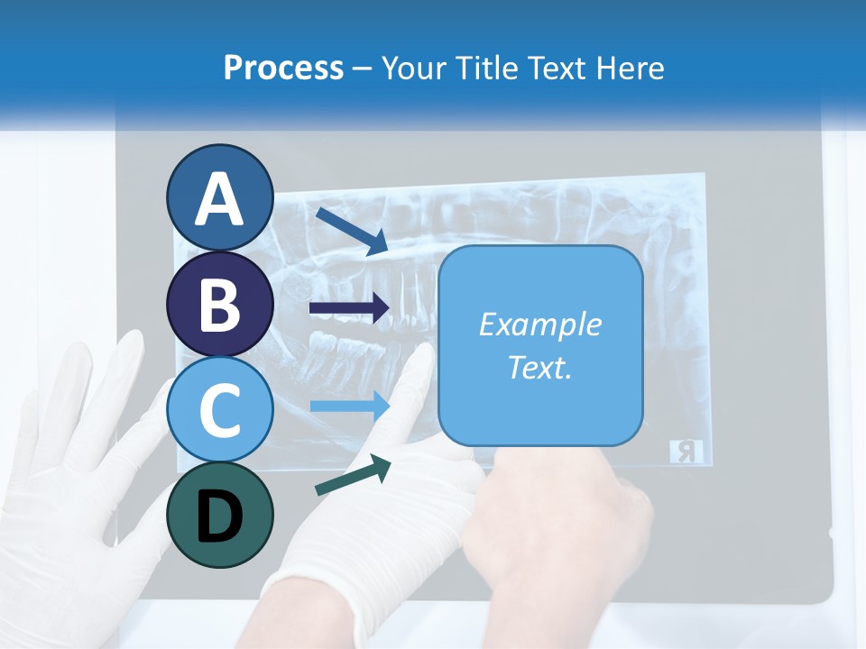A Person In White Gloves Pointing At A X - Ray PowerPoint Template