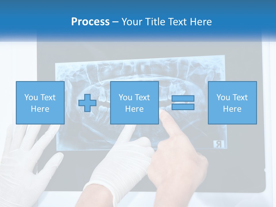 A Person In White Gloves Pointing At A X - Ray PowerPoint Template