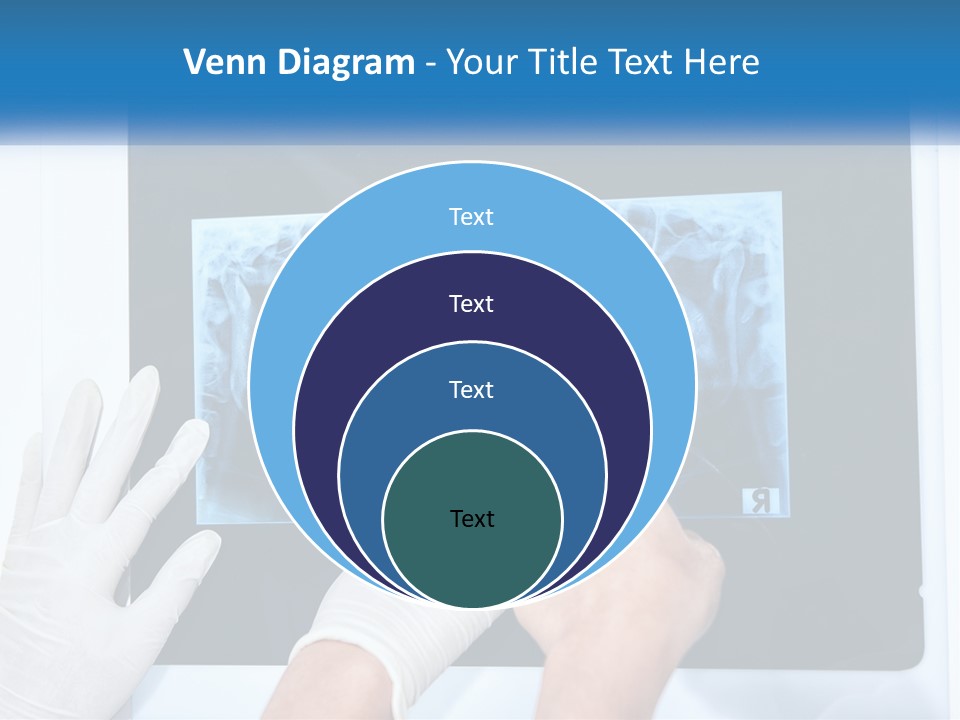 A Person In White Gloves Pointing At A X - Ray PowerPoint Template
