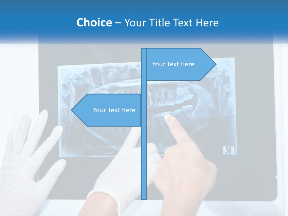A Person In White Gloves Pointing At A X - Ray PowerPoint Template