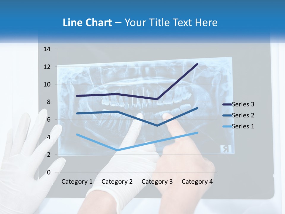 A Person In White Gloves Pointing At A X - Ray PowerPoint Template