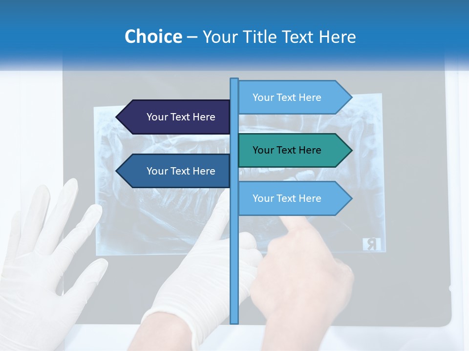 A Person In White Gloves Pointing At A X - Ray PowerPoint Template