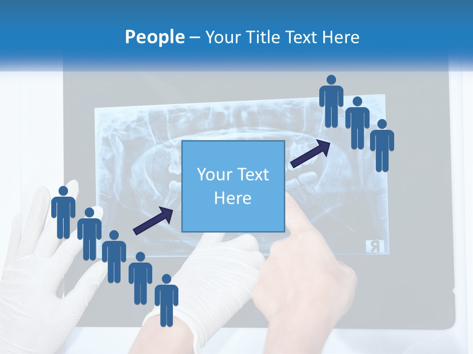 A Person In White Gloves Pointing At A X - Ray PowerPoint Template