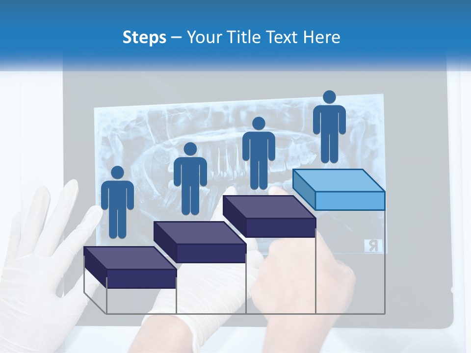 A Person In White Gloves Pointing At A X - Ray PowerPoint Template